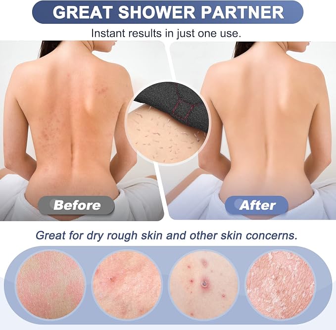 Exfoliating Back Scrubber with Handles, 38.5 Inch Double-Sided Back Exfoliator - Image 6