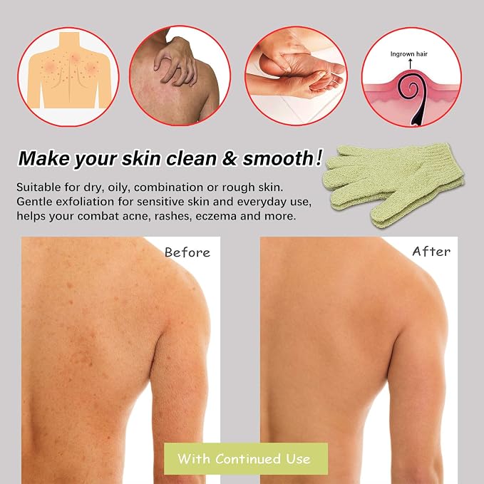 MIG4U Shower Exfoliating Scrub Gloves, Bathing Gloves Body Wash Dead Skin - Image 3