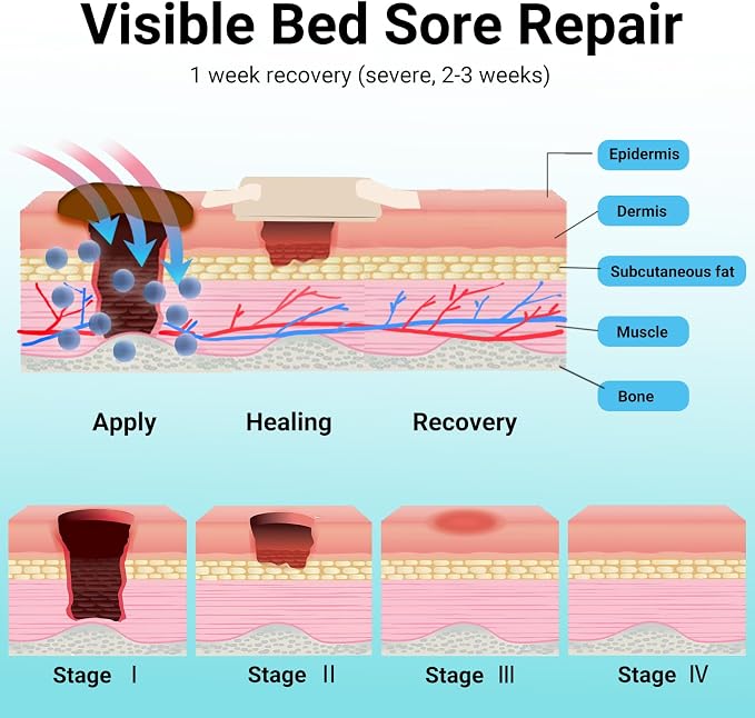 ishancare® Bed Sore Cream - Image 6