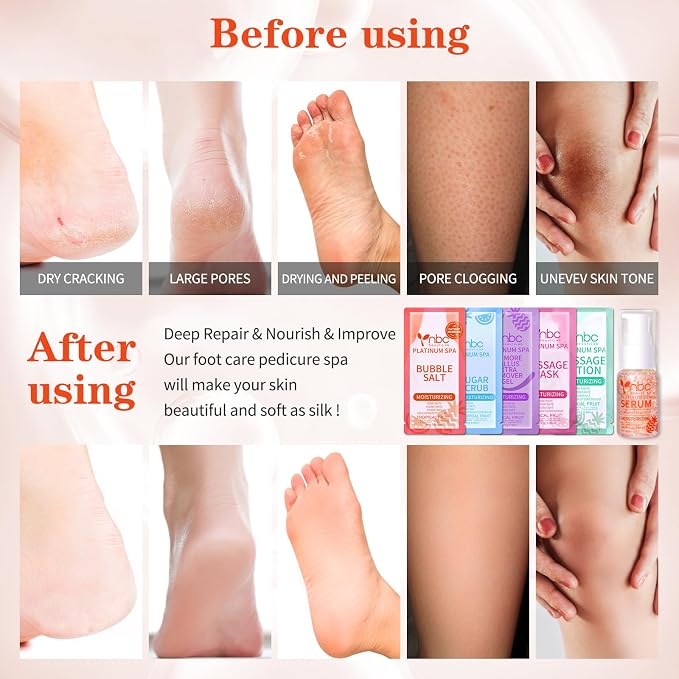 Pedicure Foot Soak Set - Image 3