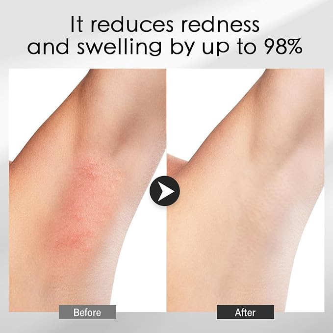 Cooling Gel for Hair Removal Device 300g Soothing Cooling Conductive Gel on - Image 5