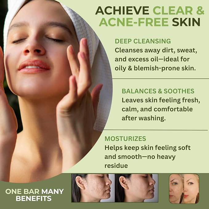 Romancy Tea Tree Antifungal Soap Bar - Image 5