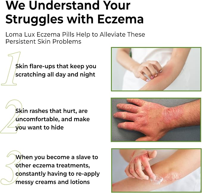 Loma Lux Eczema Pills – Natural Eczema Treatment Relief Remedy – Dermatologist - Image 4