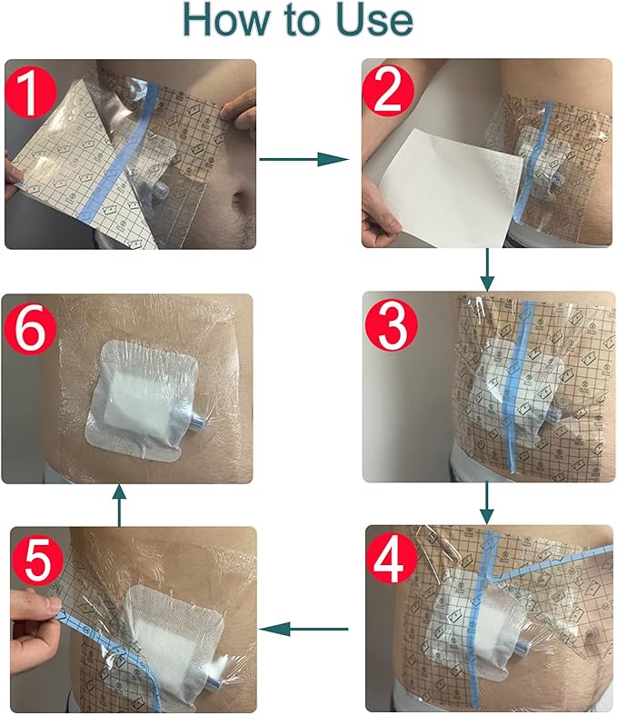 25 Pcs Waterproof PD Dialysis Catheter Wound Cover Shields Island Dressing - Image 5