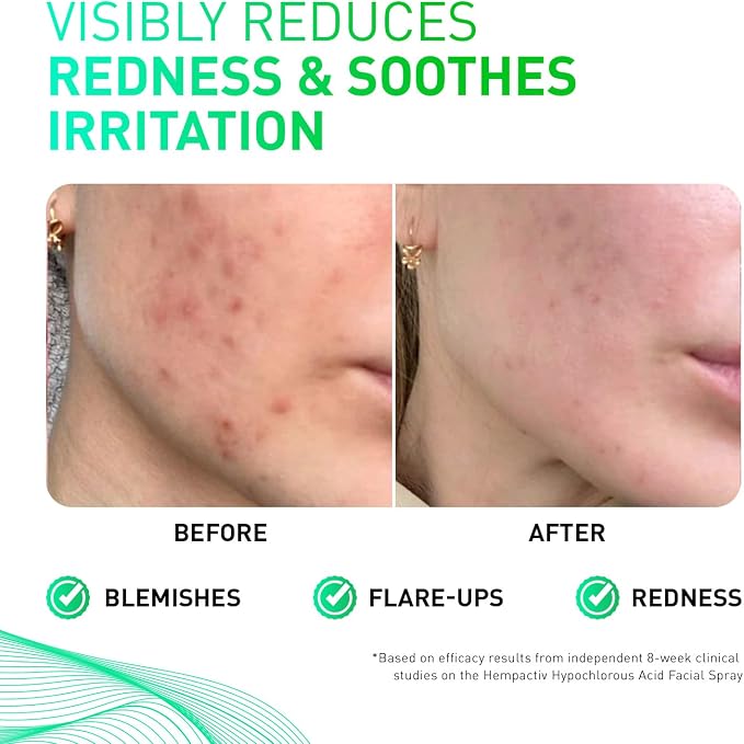 Hypochlorous Acid Spray for Face & Skin – Post-Workout Gentle HOCL Facial - Image 3