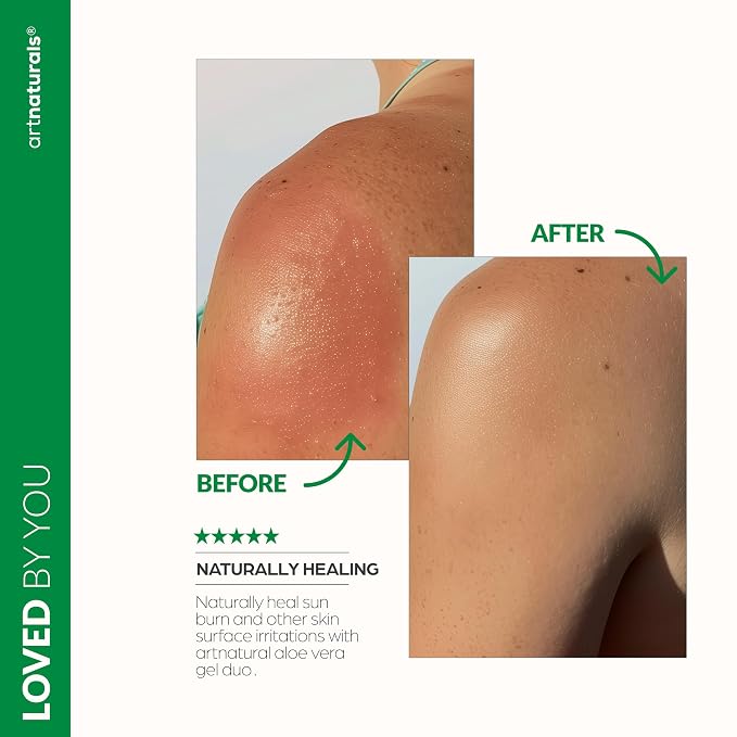 artnaturals Aloe Vera Gel Set - Image 5
