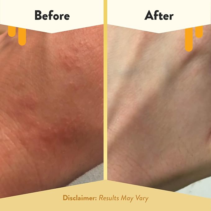 ECZEMA HONEY Oatmeal Body Lotion - Image 4