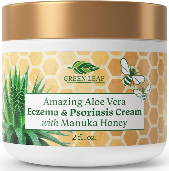Manuka Honey Eczema Cream Moisturizing Lotion Treatment by AmazingAloeVerabyGLN