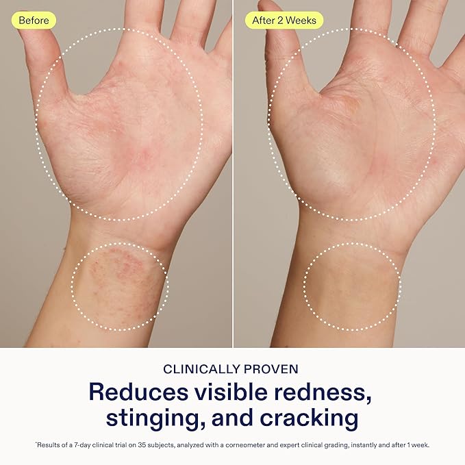 Skinfix Hand Relief Cream - Image 3