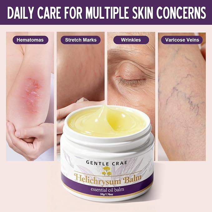 Extracts Helichrysum Balm — Moisturizing Helichrysum Essential Oil Balm - Image 5