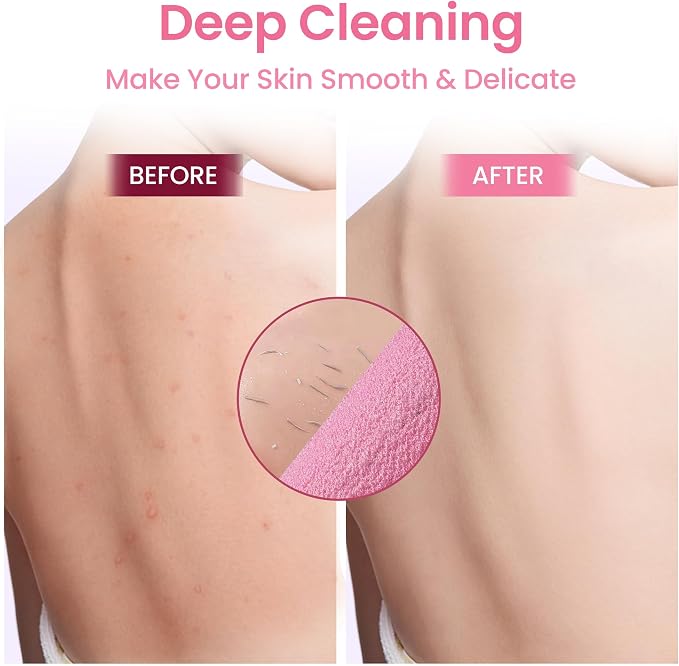3 Pcs Double-Sided Back Exfoliator Body Scrub Towel, Exfoliating Back Scrubber - Image 4