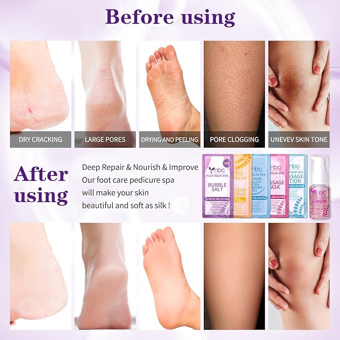 Pedicure Foot Soak Set - Image 4