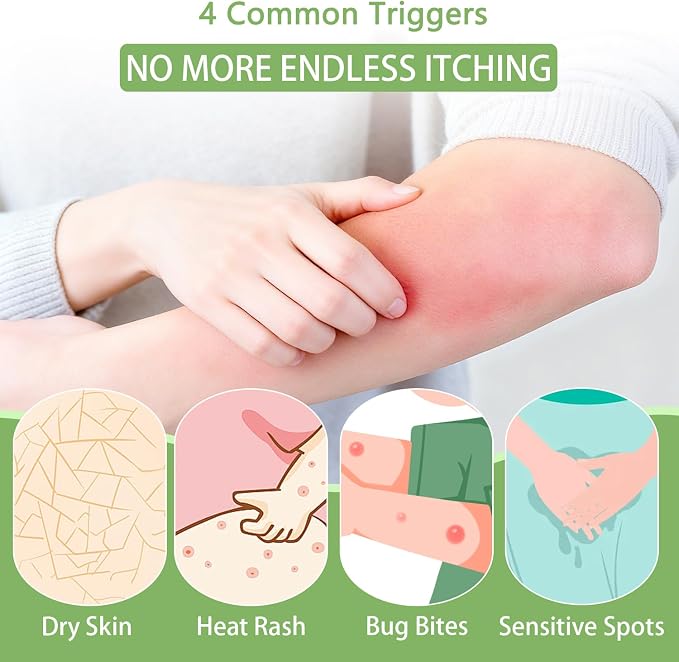 Umex Intensive Itch Relief Cream - Image 4