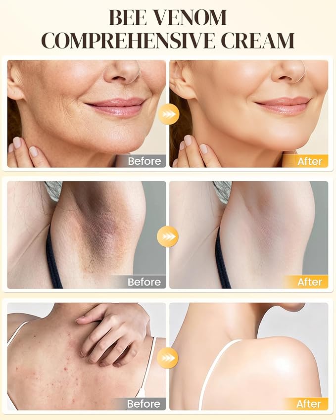 Bee Venom Comprehensive Cream, Bee Venom Skin Treatment Cream, All-in-One - Image 5