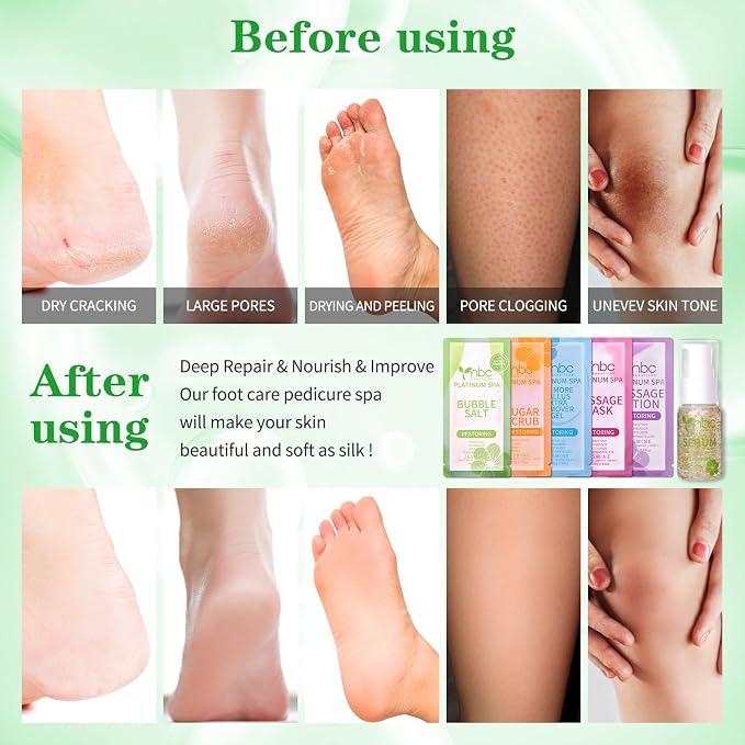 Pedicure Foot Soak Set - Image 3