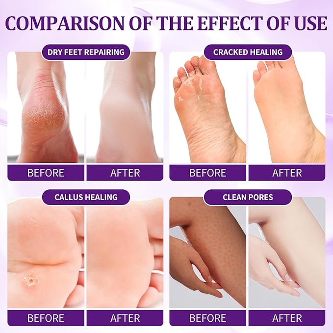 24 PCS Foot Soak, Pedicure Kit Foot Soak Set - Image 3