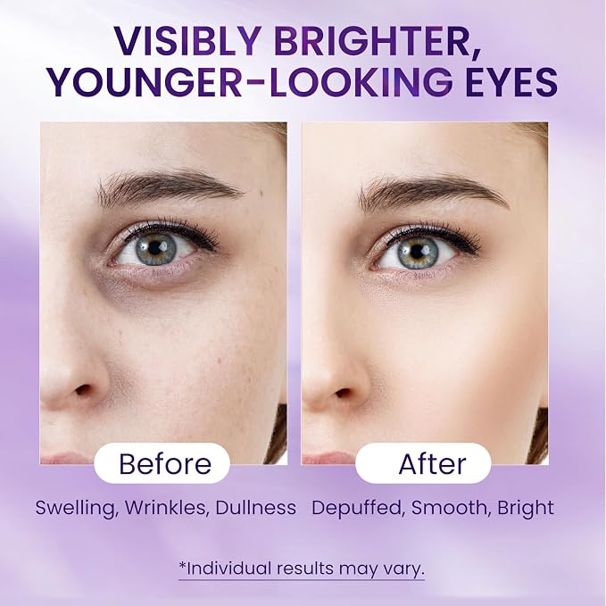 Caffeine & Retinol Under Eye Serum – Dermatologist-Tested, Fast Absorbing - Image 3