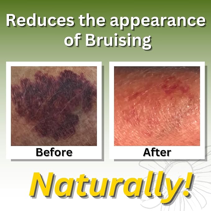 Relief Arnica Massage Oil for Massage Therapy, Home Use & Therapeutic Massaging - Image 6