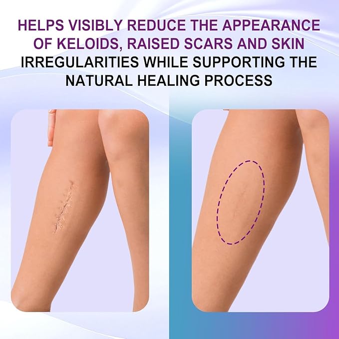 Silicone Scar Gel, Intensive Scar Cream, 2.1oz Keloid Bump Removal - Image 3