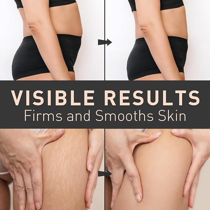 Enaskin Naturals Belly Firming Cream: B Flat Skin Tightening, Cellulite & - Image 6
