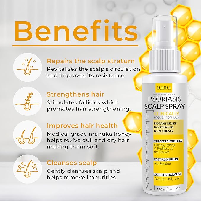 Psoriasis Scalp Spray | Psoriasis and Dandruff Treatment - Image 2