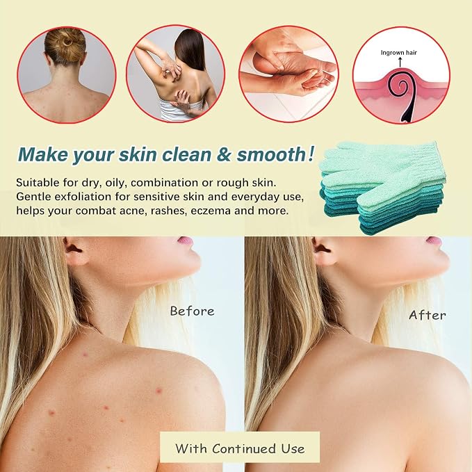MIG4U Shower Exfoliating Scrub Gloves, Bathing Gloves Body Wash Dead Skin - Image 5