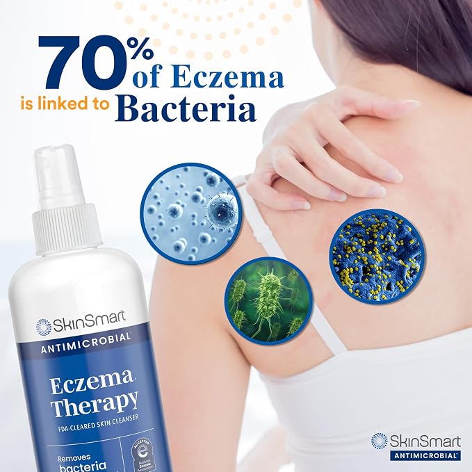 SkinSmart Antimicrobial Eczema Therapy - Image 2