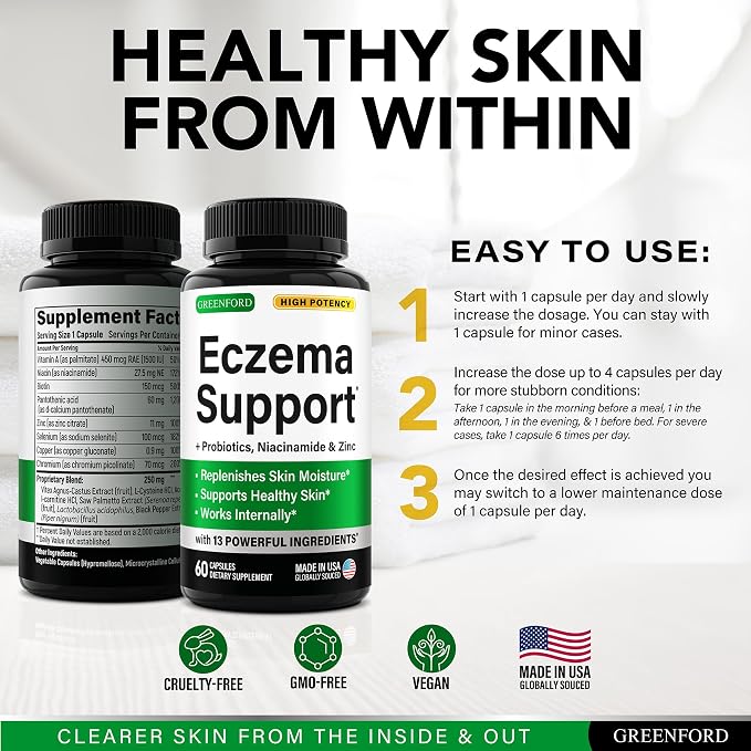 Greenford Eczema Treatment & Support - Image 6