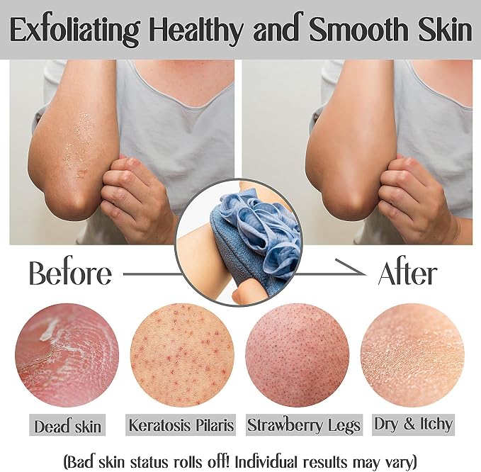 Deep Exfoliating Mitt Double-Sided Glove - Image 5