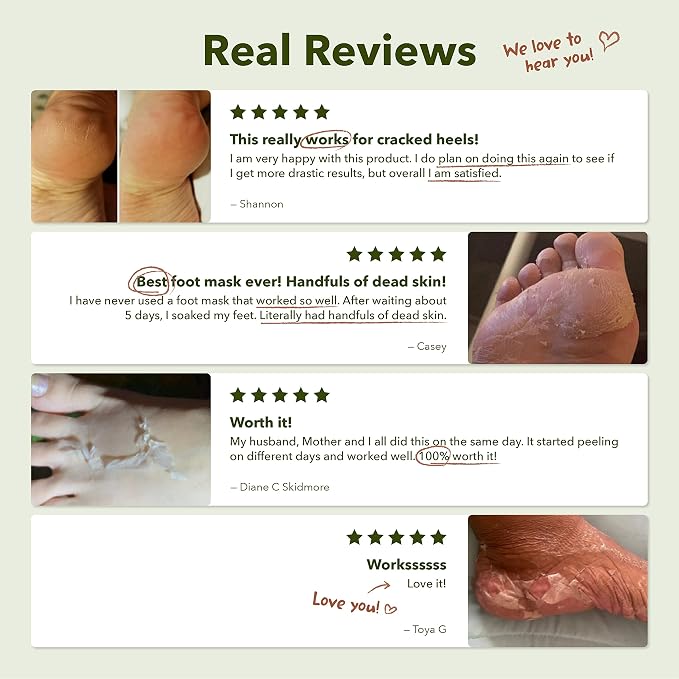 Purederm Shiny & Soft Foot Peeling Mask - Image 6