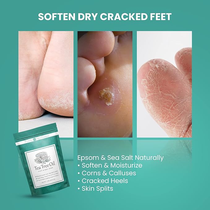 3 Pounds-Tea Tree, Peppermint, Foot Soak | MSM - Image 9