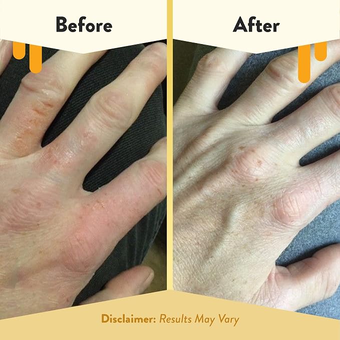 ECZEMA HONEY Oatmeal Hand Cream - Image 4