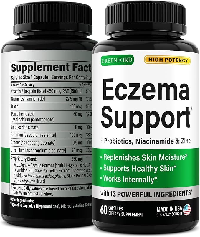 Greenford Eczema Treatment & Support by Greenford