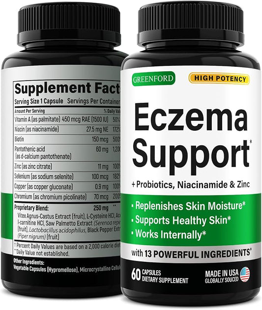 Greenford Eczema Treatment & Support by Greenford
