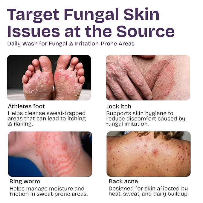 Antifungal Tea Tree Body Wash - Image 2