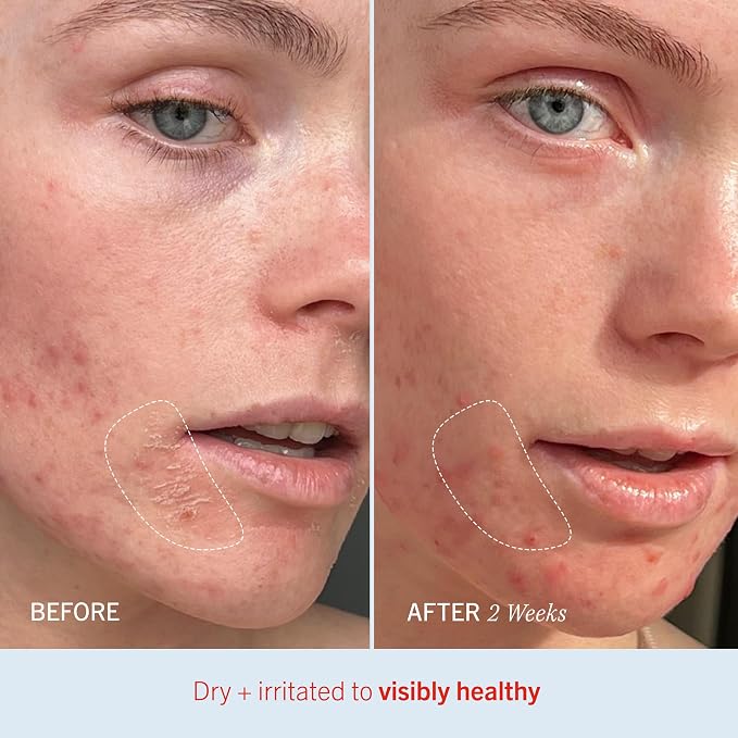 First Aid Beauty - Image 5