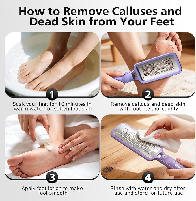 BALUCA Professional Foot File & Callus Remover - Image 8