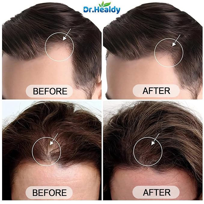Dr.Healdy Batana Oil Shampoo for Hair Growth, Against Hair Loss & Moisturizes - Image 6