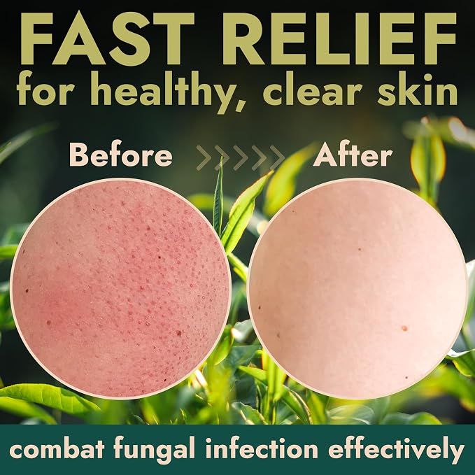 Terramed Just Think Comfort Antifungal Body Scrub - Image 4