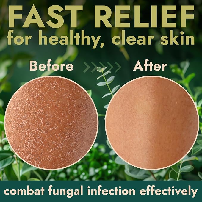 Antibacterial Body Wash | Antifungal Soap - Image 5