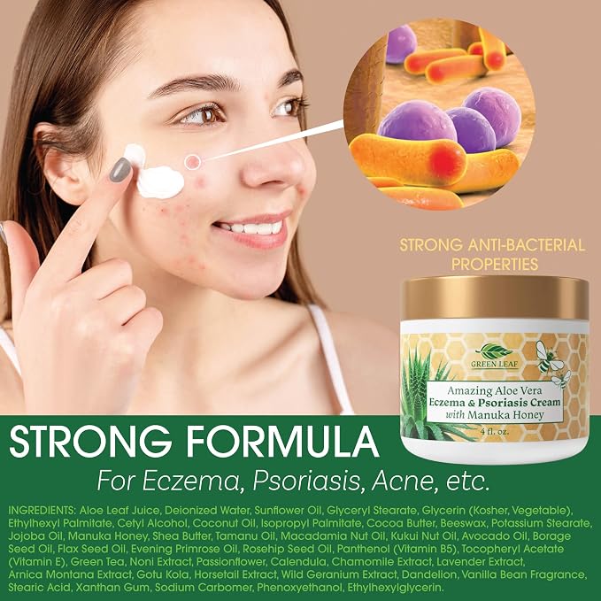Manuka Honey Eczema Cream Moisturizing Lotion - Image 2