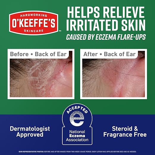 O’Keeffe’s Skin Repair Eczema Relief Body Cream, 7oz Tube – 48 Hour Itch Relief - Image 3