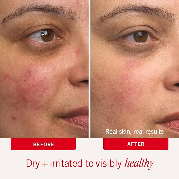 First Aid Beauty - Image 4