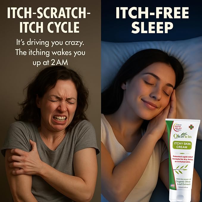 Oleavicin Extra Strength Anti-Itch Cream - Image 2