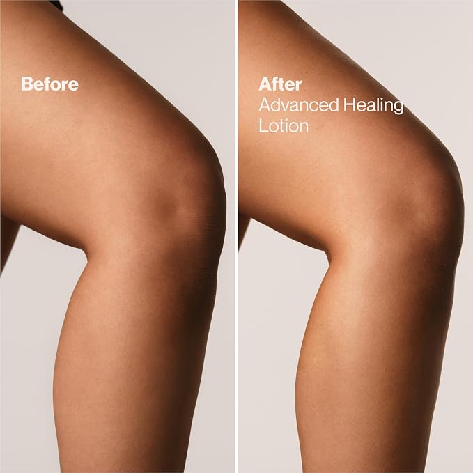 Suave+ Advanced Healing Hand & Body Lotion - Image 7