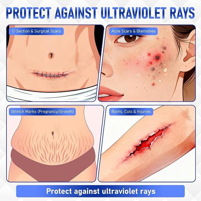 Silicone Scar Cream Gel - Image 6