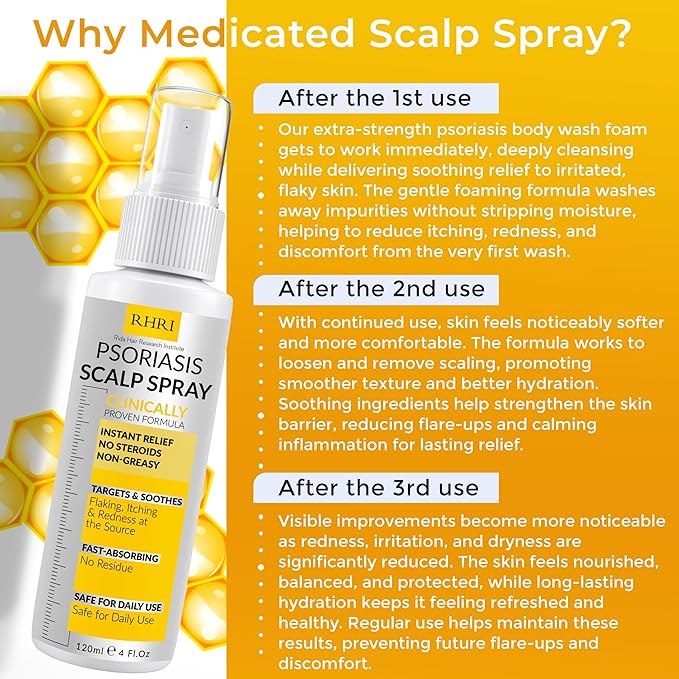 Psoriasis Scalp Spray | Psoriasis and Dandruff Treatment - Image 4
