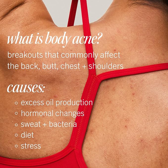 First Aid Beauty Body Acne Spray - Image 9